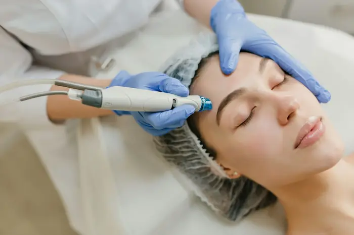 A microneedling device being used on a client’s forehead